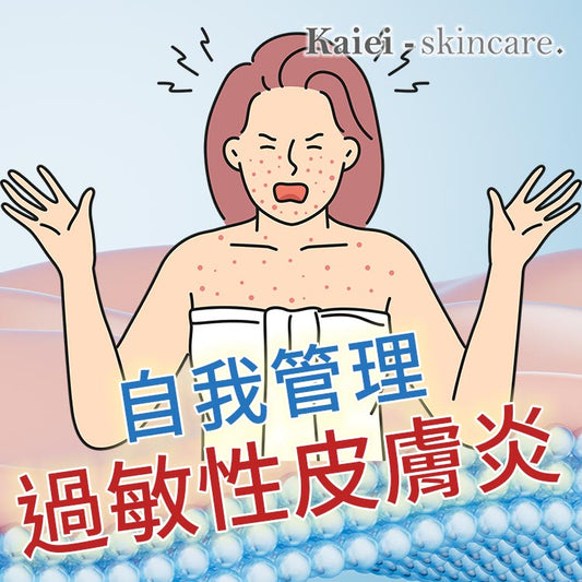 如何自我管理過敏性皮膚炎?