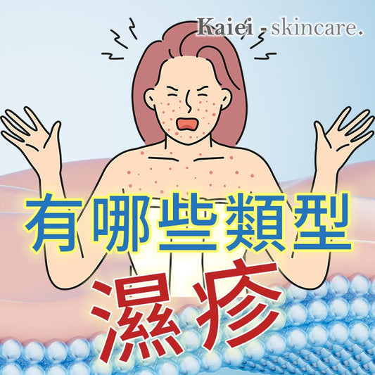 濕疹有哪些類型?
