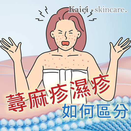 蕁麻疹與濕疹如何區分