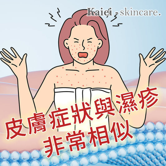 那些皮膚問題與濕疹很相似?