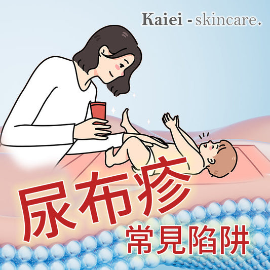 尿布疹有哪些常見迷思?