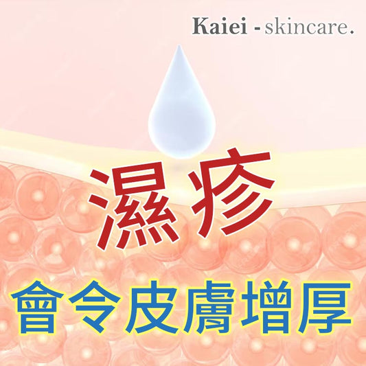 濕疹會令皮膚增厚...點算好?