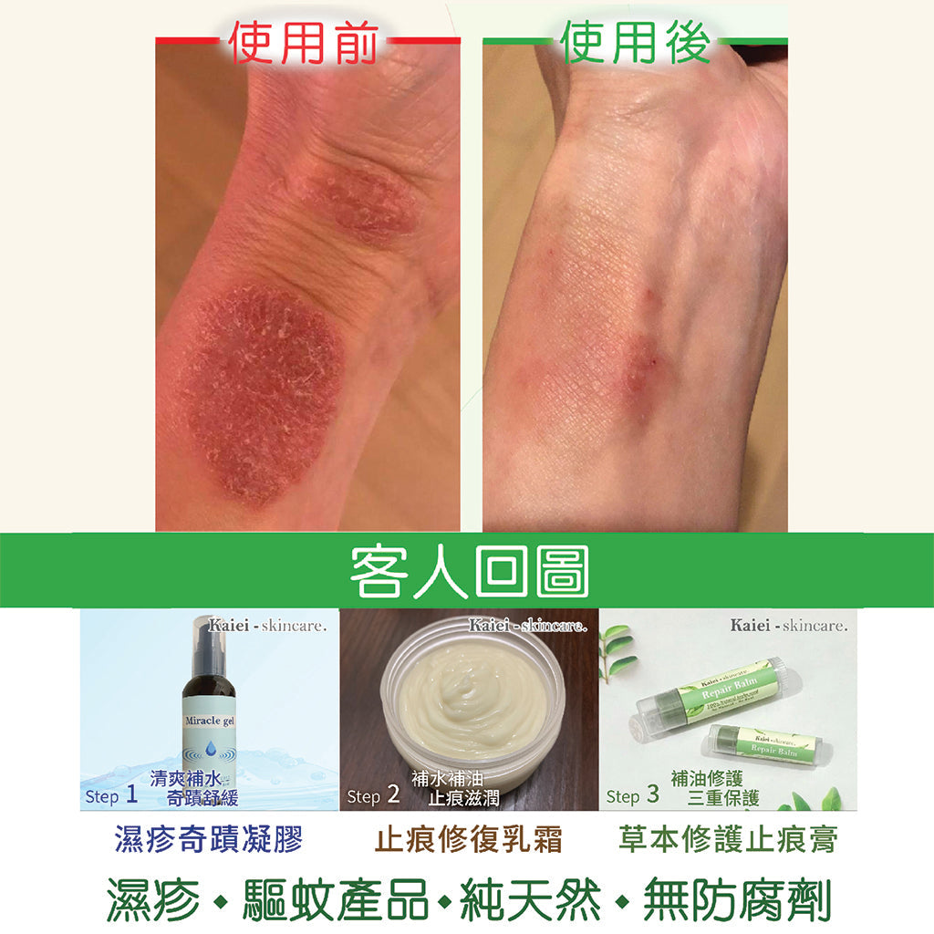 濕疹產品 - 草本護理新體驗