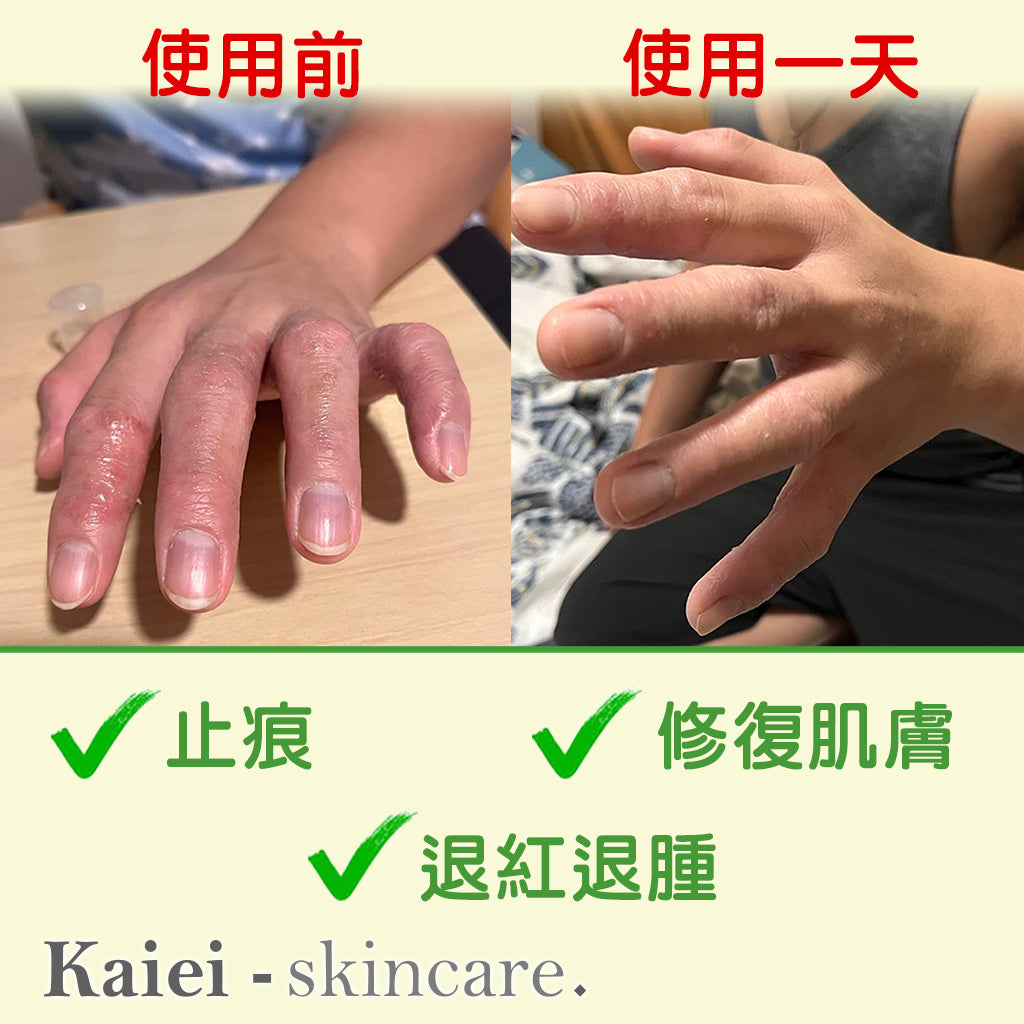 草本修護止痕膏