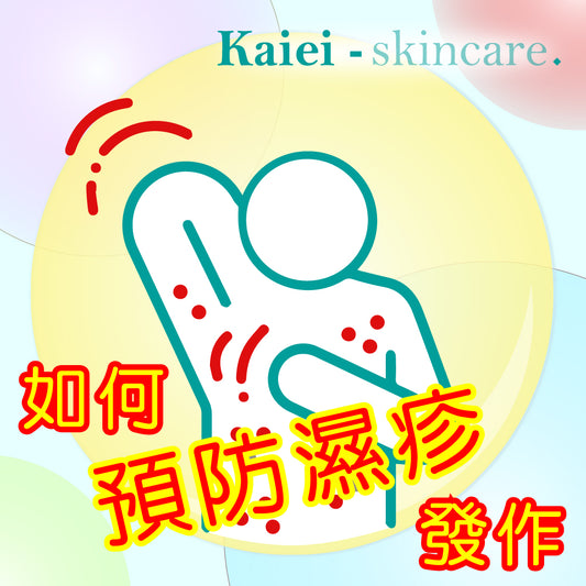 如何預防濕疹發作？