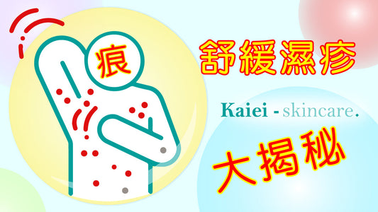 不使用類固醇也能舒緩皮膚，濕疹患者最推薦的舒緩濕疹大揭秘