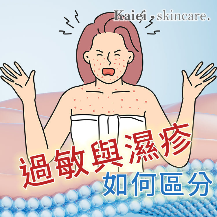 過敏與濕疹如何區分