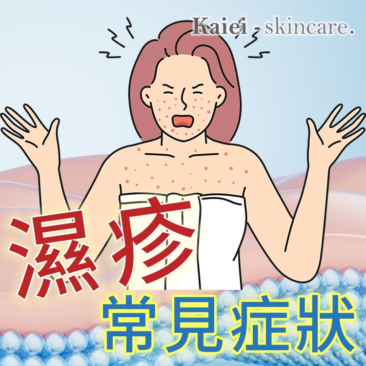 濕疹有哪些常見的症狀？