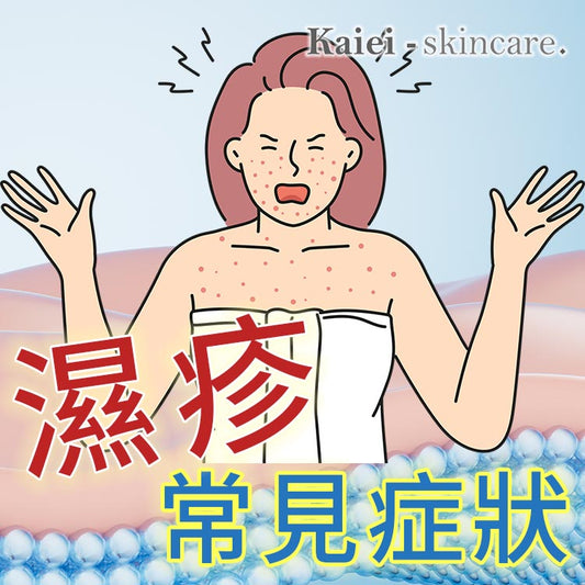 濕疹有哪些常見的症狀？