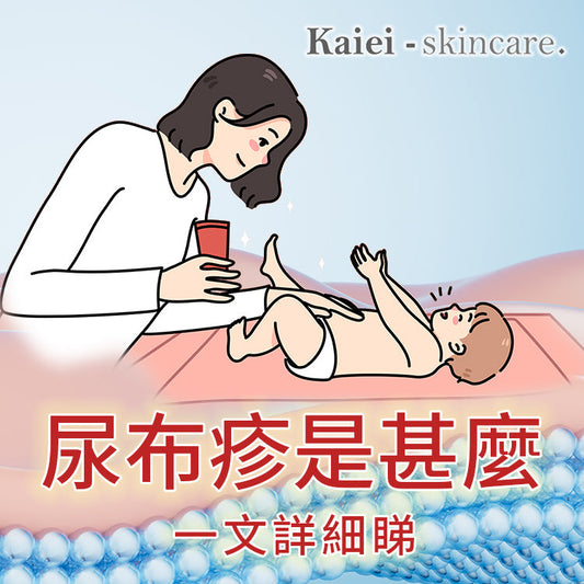 尿布疹是甚麼-一文詳細睇