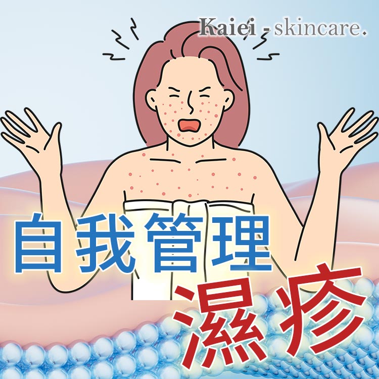 如何自我管理濕疹？