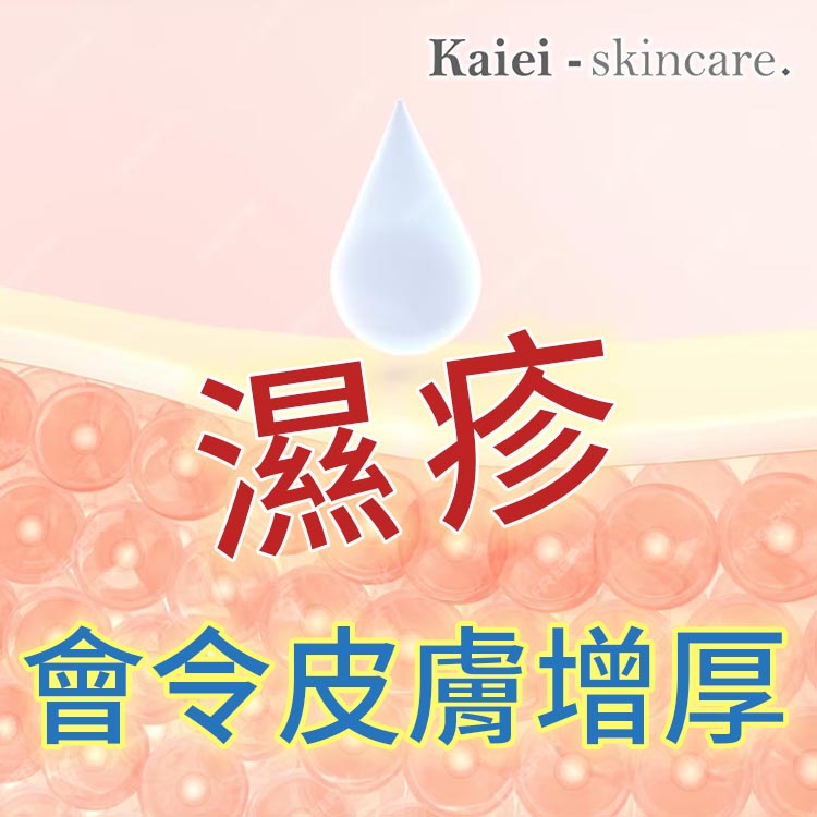 濕疹會令皮膚增厚...點算好?