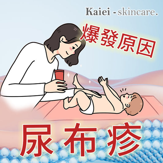 尿布疹有哪些常見原因？