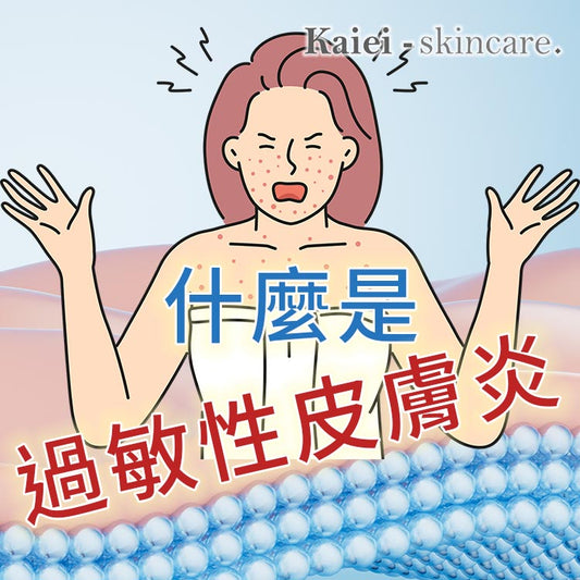 什麼是過敏性皮膚炎?